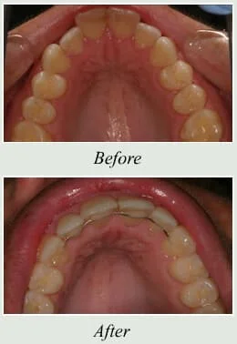 NJ Laser Dentistry