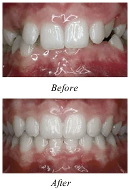 Dentist Tinton Falls NJ