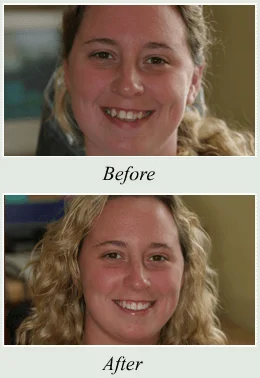 Dentist in Tinton Falls NJ
