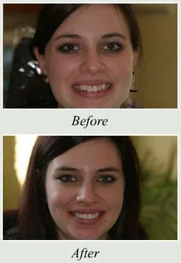Dentist Tinton Falls