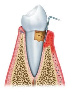 NJ Laser Dentistry