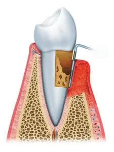 Dentist in Tinton Falls NJ