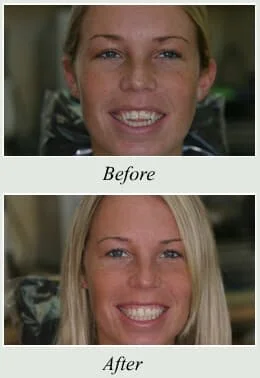 Dentist Near Me