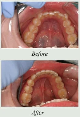 Dentist in Tinton Falls