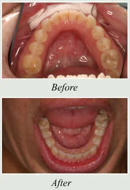 Tinton Falls Dentist