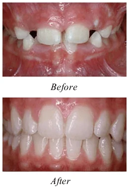 Tinton Falls NJ Dentist